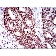 Western blot analysis using WHSC2 antibody against human WHSC2 recombinant protein. (Expected MW is 50.2 kDa).