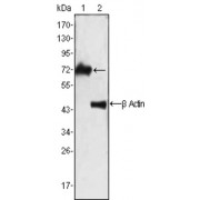 Western blot analysis using ZAP70 antibody against Jurkat cell lysate (1).