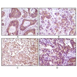 Inhibitor of Nuclear Factor Kappa-B Kinase Subunit Beta / IKKB (IKBKB) Antibody