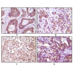 Inhibitor of Nuclear Factor Kappa-B Kinase Subunit Beta / IKKB (IKBKB) Antibody