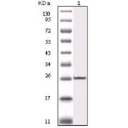 Western blot analysis using IKBKB antibody against truncated IKBKB recombinant protein (1).