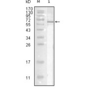 Western blot analysis using Influenza A virus Nucleoproteinantibody against full-length recombinant Influenza A virus Nucleoprotein.