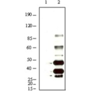 Western blot analysis using KSHV K8α antibody against BCBL-1 (1) and TPA induced BCBL-1 (2) cell lysate.