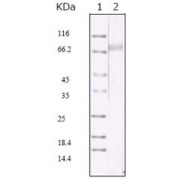 Western blot analysis using KSHV ORF45 antibody against KSHV ORF45 recombinant protein.