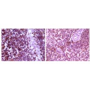 Immunohistochemical analysis of paraffin-embedded human thymoma tissue (left) and spleen tissue (right), showing cytoplasmic localization using MAP2K4 antibody with DAB staining.