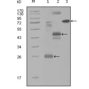 Western blot analysis using MAP4K4 antibody against truncated Trx-MAP4K4 recombinant protein (1), MBP-MAP4K4 (aa300-400) recombinant protein (2) and MAP4K4 (aa194-436) -hIgGFc transfected CH0-K1 cell lysate (3).