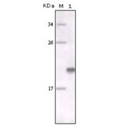 Western blot analysis using MER antibody against full-length MER recombinant protein.