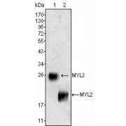 Western blot analysis using MYL3 (1) and MYL2 (2) antibody against rat fetal heart tissues lysate.