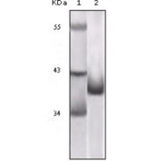Western blot analysis using P16 antibody against truncated P16 recombinant protein.