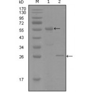 Western blot analysis using PGR antibody against truncated MBP-PGR recombinant protein (1) and truncated Trx-PGR (aa730-871) recombinant protein (2).