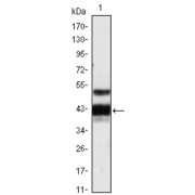 Western blot analysis using PROZ antibody against human plasma (1).