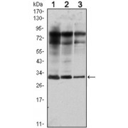Western blot analysis using Rab25 antibody against MCF-7 (1), T47D (2) and GC7901 (3) cell lysate.