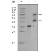 Western blot analysis using RET antibody against truncated RET recombinant protein (1) and RET (aa658-1063) -hIgGFc transfected CHO-K1 cell lysate (2).