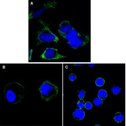 Confocal immunofluorescence analysis of Hela (A), A431 (B) and THP-1 (C) cells using RTN3 antibody (green). Blue: DRAQ5 fluorescent DNA dye.