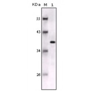 Western blot analysis using S100B antibody against full-length S100B recombinant protein.