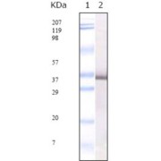 Western blot analysis using SARS-E2GP3 antibody against SARS-E2GP3 recombinant protein.