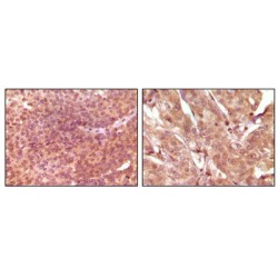 Steroid Receptor Rna Activator 1 (SRA) Antibody
