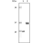 Western blot analysis using SRA antibody against truncated SRA recombinant protein (1) and human ovary cancer tissue lysate (2).