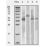 Western blot analysis using Trx antibody against various fusion protein with Trx tag.
