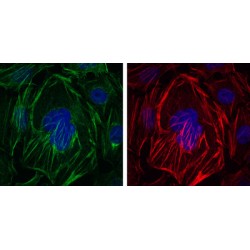 Actin Alpha 2, Smooth Muscle (ACTA2) Antibody