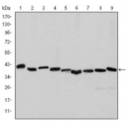 Western blot analysis using ACTA2 antibody against Hela (1), A431 (2), Jurkat (3), K562 (4), HEK293 (5), HepG2 (6), NIH/3T3 (7), PC-12 (8) and Cos7 (9) cell lysate.