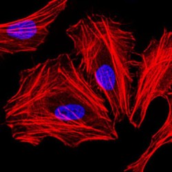 CCAAT/Enhancer Binding Protein Alpha (CEBPA) Antibody