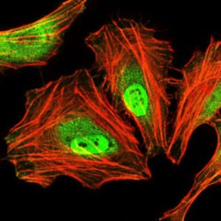 CCAAT/Enhancer Binding Protein Alpha (CEBPA) Antibody