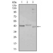 Western blot analysis using CEBPA antibody against Jurkat (1), k562 (2), and HepG2 (3) cell lysate.