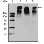 Western blot analysis using KI67 antibody against Hela (1), MCF-7 (2) and Raji (3) cell lysate.