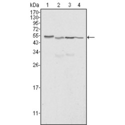 Calreticulin (CALR) Antibody