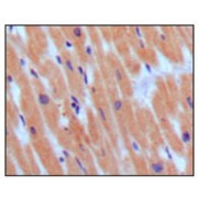 Immunohistochemical analysis of paraffin-embedded human normal myocardium, showing cytoplasmic localization using BNP3 antibody with DAB staining.