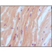 Immunohistochemical analysis of paraffin-embedded human normal myocardium, showing cytoplasmic localization using BNP2 antibody with DAB staining.