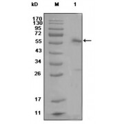 Western blot analysis using ESR1 antibody against MCF-7 cell lysate (1).