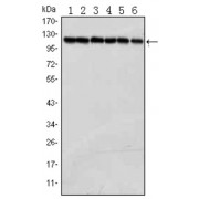 Western blot analysis using PARP antibody against Jurkat (1), K562 (2), Hela (3), Raji (4),THP-1 (5) and SW620 (6) cell lysate.
