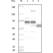 Western blot analysis using anti-KSHV ORF8 polyclonal antiobdy against uninduced BCBL1 cell lysate (1), TPA induced BCBL1 cell lysate (2) and purified virion (3).