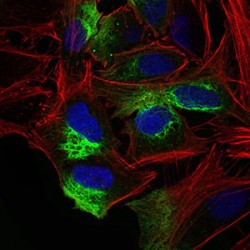 Zinc Finger E-Box-Binding Homeobox 1 (ZEB1) Antibody