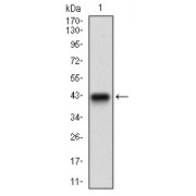 WB analysis of recombinant Human ZEB1 (Expected MW: 41.7 kDa).
