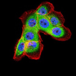 Ferritin Light Chain (FTL) Antibody