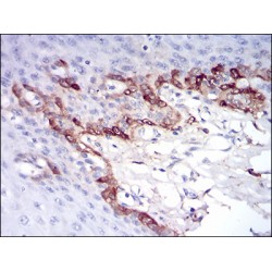 Ferritin Light Chain (FTL) Antibody