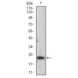 Ferritin Light Chain (FTL) Antibody