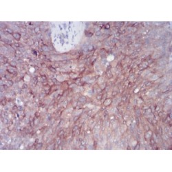 Rab11 Family-Interacting Protein 1 (RAB11FIP1) Antibody