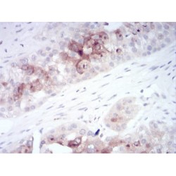 Rab11 Family-Interacting Protein 1 (RAB11FIP1) Antibody