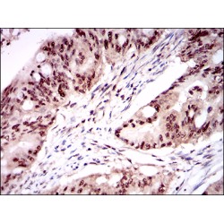 One Cut Domain Family Member 3 (ONECUT3) Antibody