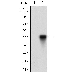 One Cut Domain Family Member 3 (ONECUT3) Antibody