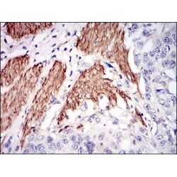 NPC Intracellular Cholesterol Transporter 1 (NPC1) Antibody