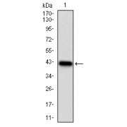 Western blot analysis of human NPC1 recombinant protein. (Expected MW: 37.6 kDa)
