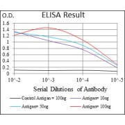 Fig. 1. Black line: Control Antigen (100 ng); Purple line: Antigen(10ng); Blue line: Antigen (50 ng); Red line: Antigen (100 ng)