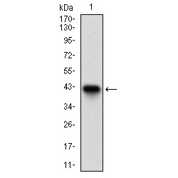 Tartrate-Resistant Acid Phosphatase 5 / TRACP5 (ACP5) Antibody