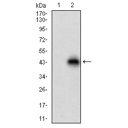 Tartrate-Resistant Acid Phosphatase 5 / TRACP5 (ACP5) Antibody