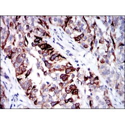 Keratin, Type II Cytoskeletal 5 (KRT5) Antibody